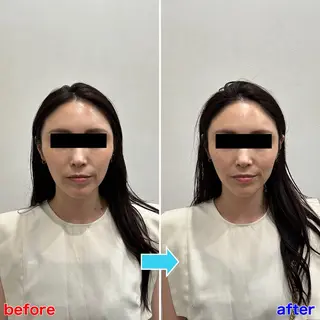 小顔矯正・美容鍼 FLOW鍼灸整体院のエステ・リラクイメージ