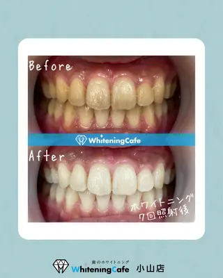 ホワイトニングカフェ 小山店のエステ・リラクイメージ