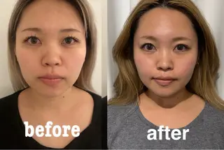 美容鍼灸サロン mahoroba院長のエステ・リラクイメージ