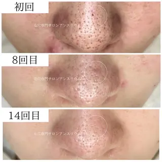 毛穴ケア専門サロンアンスリウム所属・茨城土浦 つくば毛穴 ケア専門サロンのエステ・リラクイメージ