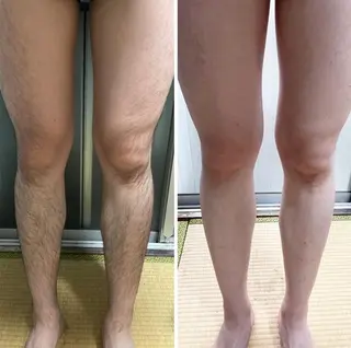 ヘアアレンジ 別府脱毛サロン Grandeのエステ・リラクイメージ