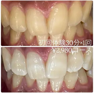 ホワイトニングルーム 横浜店のその他イメージ