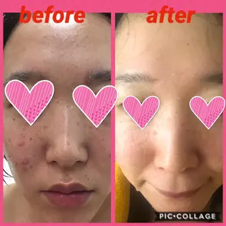 YOSAPARK八王子店所属・YOSAPARK 八王子店のエステ・リラクイメージ