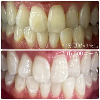 ホワイトニングルーム 横浜店のその他イメージ