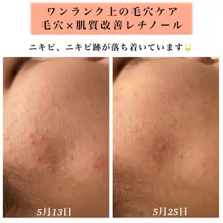 Bellesthe (ベルエステ)のエステ・リラクイメージ