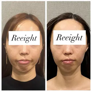 肌質改善専門 ハーブ /毛穴洗浄 リエイトのエステ・リラクイメージ