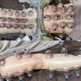 salon HACHI♾のマツエク・マツパデザイン