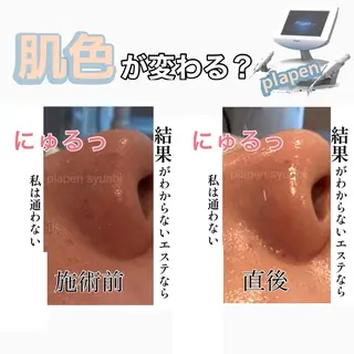 Lumiere despoirのエステ・リラクイメージ