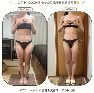 《本気痩せ×疲労改善 》  BILOOPのエステ・リラクイメージ