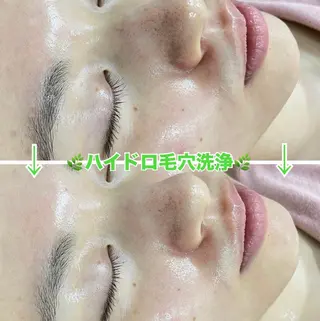 脱毛&美容サロン Dr.Epiのエステ・リラクイメージ