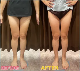 VIVACE YUMEのその他イメージ