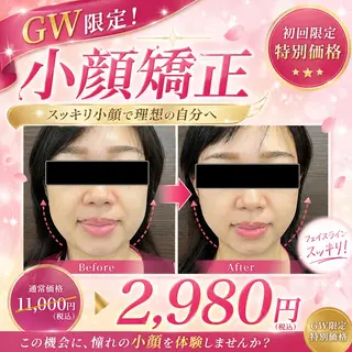 【美容鍼・小顔鍼】 鍼灸師　森原拓磨のエステ・リラクイメージ