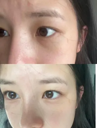 aliaハーブ水光店 エステティシャン募集のエステ・リラクイメージ