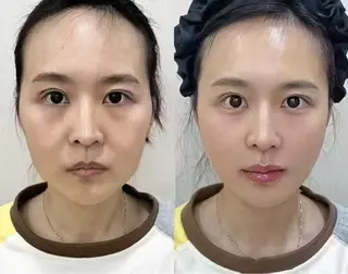 ネイル aliaハイフ&水光ジェットサロン所属・aliaハーブ水光店 エステティシャン募集のエステ・リラクイメージ