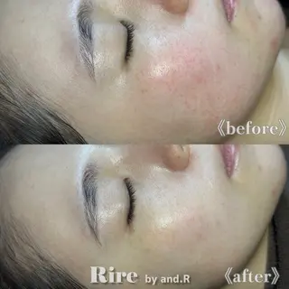 実方 梨々花のエステ・リラクイメージ