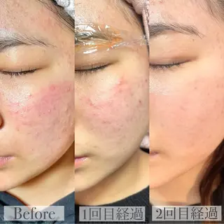 LUVRE龍田 MIKIまつ毛/眉毛の眉毛・アイブロウイメージ