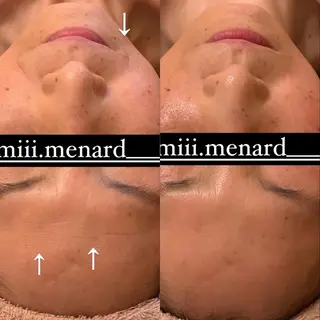 MENARD mikacoのエステ・リラクイメージ