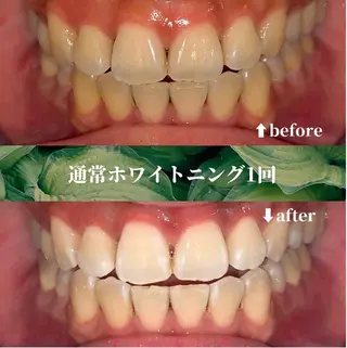 futaba ホワイトニング/天神のエステ・リラクイメージ