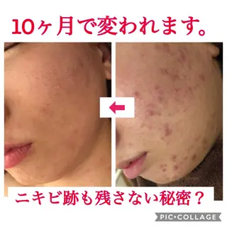セミロング カラー パーマ ヘアアレンジ メンズ キッズ ネイル マツエク・マツパ 金の糸脱毛 産毛ケア専門のエステ・リラクイメージ