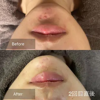 メンズ キッズ 美肌と癒しのサロン Lu,Mieのエステ・リラクイメージ