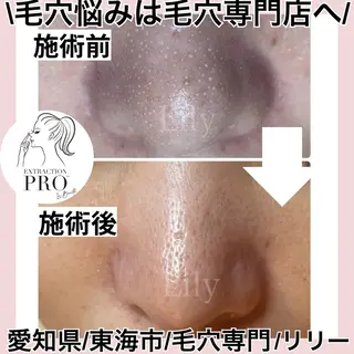 トータルビューティー サロンLilyのエステ・リラクイメージ