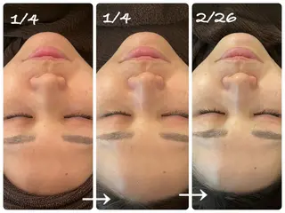 luana beauty所属・kana ハーブピーリング🌿のエステ・リラクイメージ