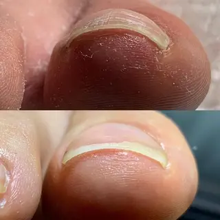 carenail　 tsugumiのその他イメージ