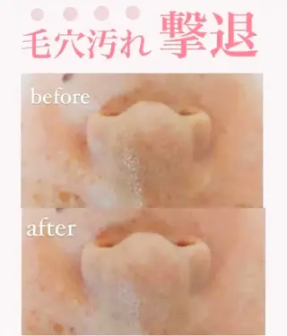 CSサロン Amule所属・Amule anna🦋のエステ・リラクイメージ