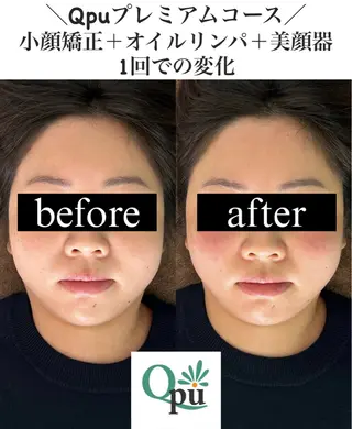 Qpu(キュープ)下北沢店所属・鮎川 さゆりのエステ・リラクイメージ