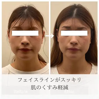 美容鍼/ヘッドスパ/ 💎さかもとのエステ・リラクイメージ