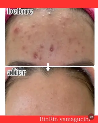 RinRin 山口店のエステ・リラクイメージ