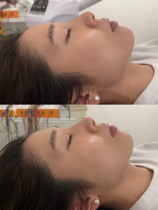 美容鍼灸サロン mahoroba院長のエステ・リラクイメージ