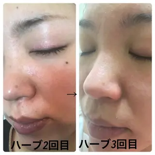 fairyrose organicエステのエステ・リラクイメージ