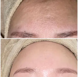 エステサロン Mi-mi.iのエステ・リラクイメージ