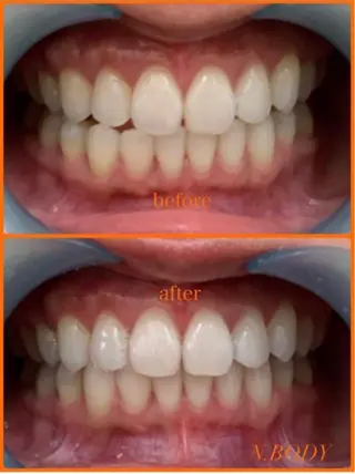 N.BODY  のエステ・リラクイメージ