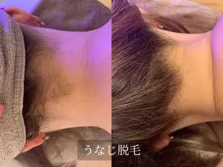 脱毛サロン Arumのエステ・リラクイメージ