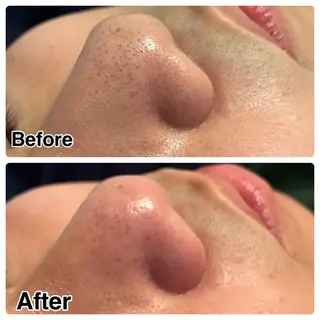 🌴Beauty Salon LANAのエステ・リラクイメージ