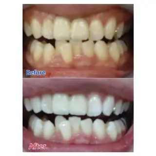 Ｍ渋谷 ホワイトニングのエステ・リラクイメージ