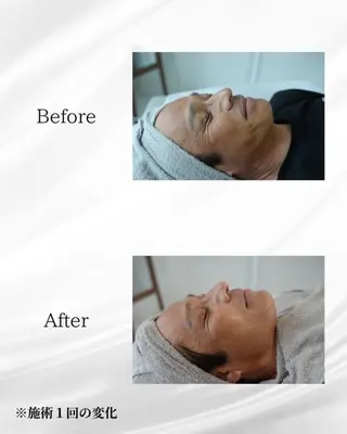 ハーブピーリング🌿 REVI/Ayanoのエステ・リラクイメージ