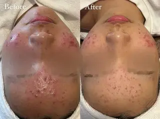 佐藤 加奈のエステ・リラクイメージ