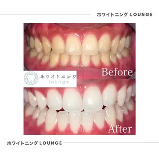ホワイトニング Lounge横須賀のエステ・リラクイメージ