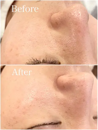 Freude所属・Freude Yamaguchiのマツエク・マツパデザイン