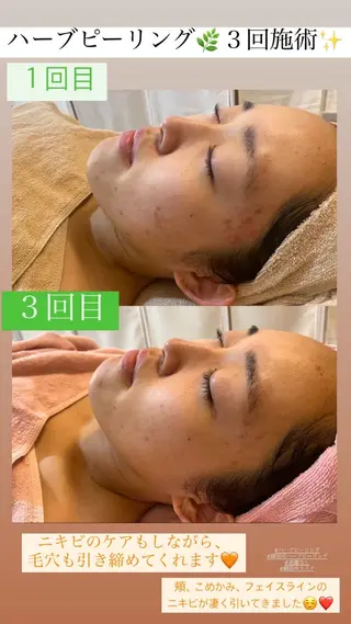 Salon de Lino 御器所のエステ・リラクイメージ