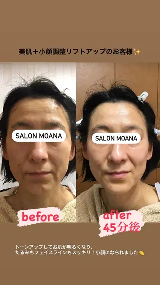 小顔美肌salon MOANAのエステ・リラクイメージ