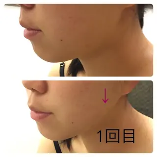 トータルビューティー マウロアのエステ・リラクイメージ