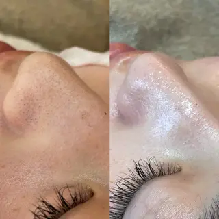 New __のその他イメージ