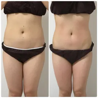 ボディケアサロン te&te  テトテのエステ・リラクイメージ