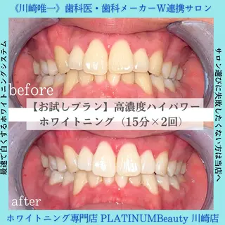 PLATINUM Beauty 川崎店のエステ・リラクイメージ