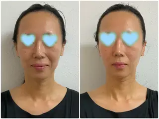 Prima（プリマ） 名古屋駅本店のエステ・リラクイメージ