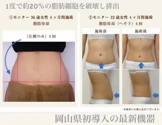 chouchou【シュシュ】所属・トータルボディケア chouchouのエステ・リラクイメージ